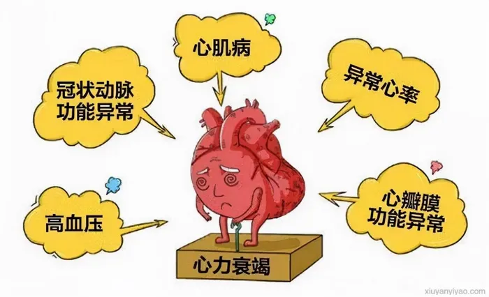 睡觉不能平卧是心衰前奏？一文解锁医学真相