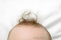 家长紧急收藏！小儿头发黄的真相全曝光