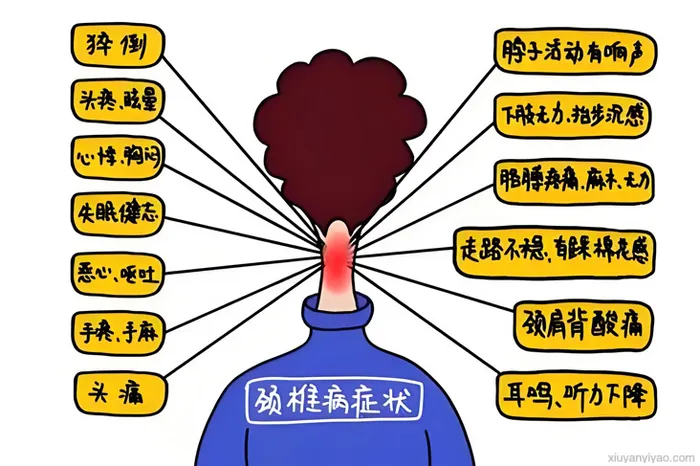 颈椎病发展的四个阶段，你在哪一级？