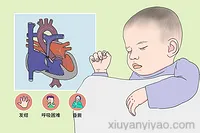  法洛四联症到底能不能治愈？中药效果怎么样？