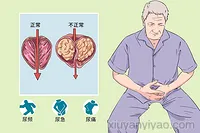 舒泌通丸治疗前列腺炎，效果到底行不行？