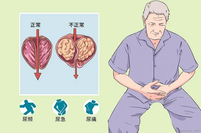 舒泌通丸治疗前列腺炎，效果到底行不行？