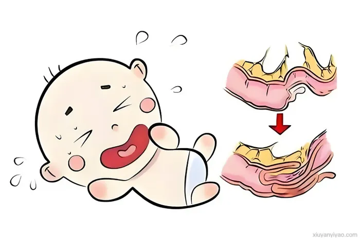 深度解析:疝气究竟需不需要手术治疗?