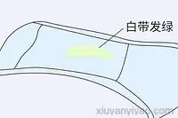 白带老是黄绿像鼻涕，隐藏在身体里的健康隐患曝光