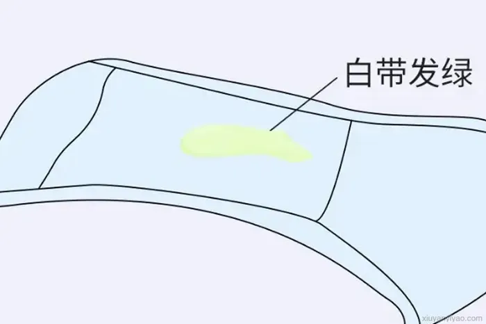 白带老是黄绿像鼻涕,隐藏在身体里的健康隐患曝光
