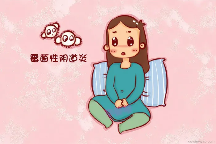 速看!霉菌性阴道炎不适缓解妙招