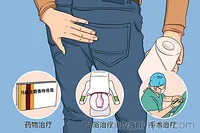 痔疮治疗方法大公开，快来一探究竟